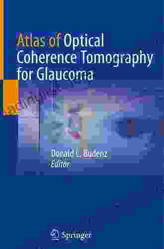 Atlas Of Optical Coherence Tomography For Glaucoma