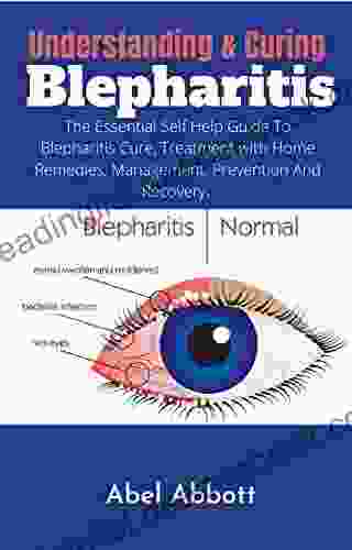 Understanding Curing Blepharitis: The Essential Self Help Guide To Blepharitis Cure Treatment With Home Remedies Management Prevention And Recovery