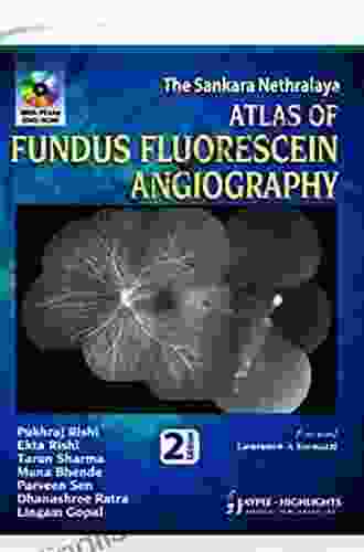 The Sankara Nethralaya Atlas Of Fundus Fluorescein Angiography